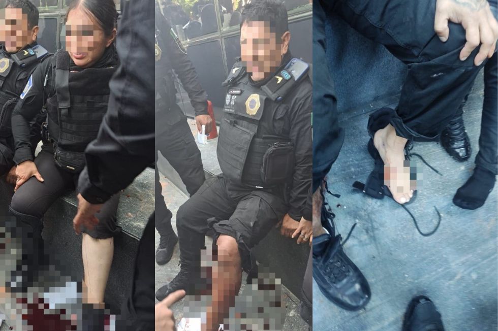 11 Policías capitalinos resultaron lesionados, tras agresiones recibidas por normalistas de Ayotzinapa